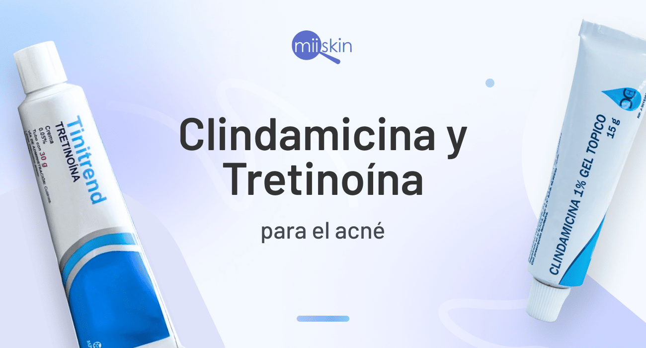 Clindamicina Y Tretino Na Para Acn Por Qu Usarlas Juntas