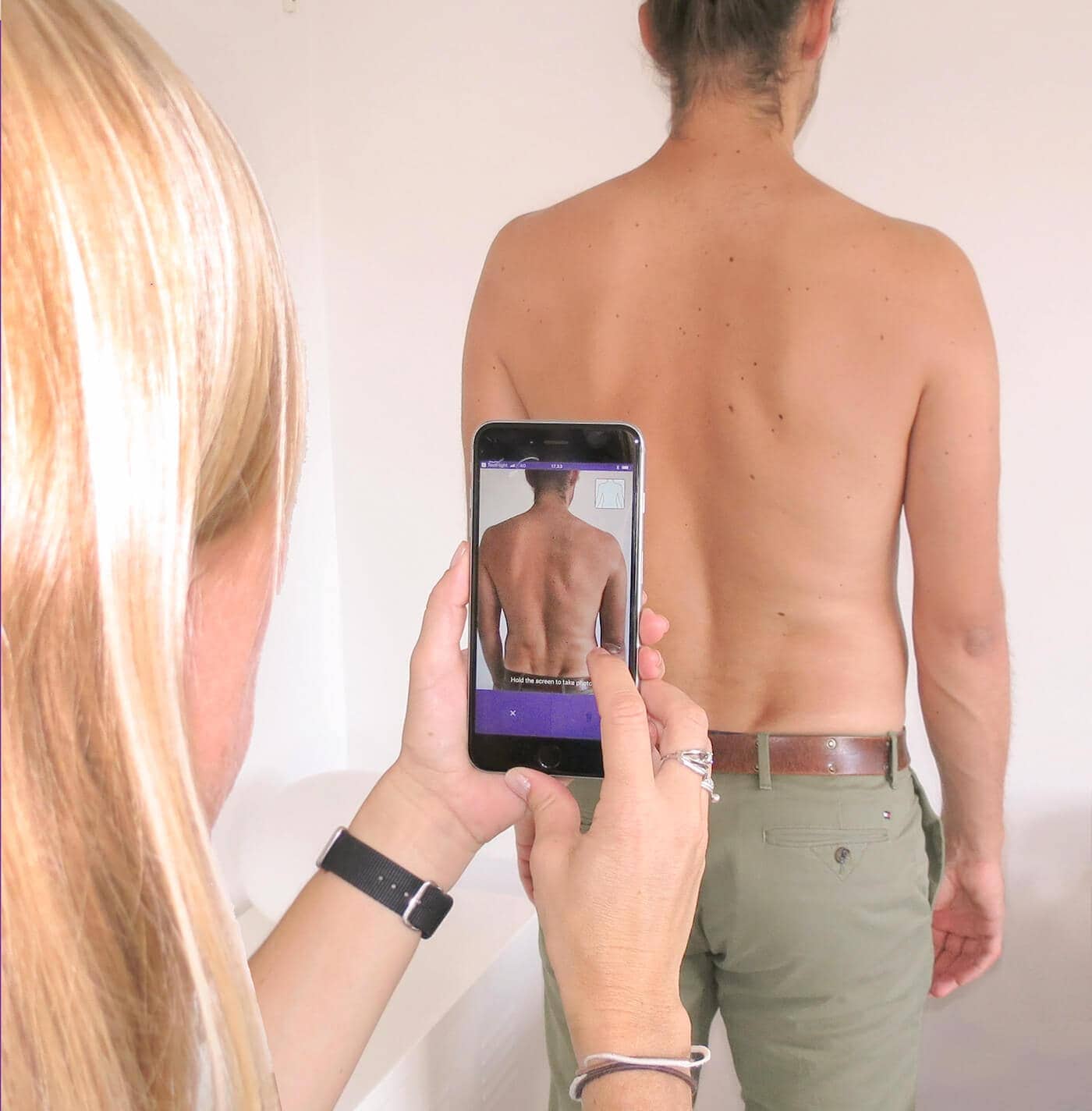 skin mapping - total body photography skin mapping