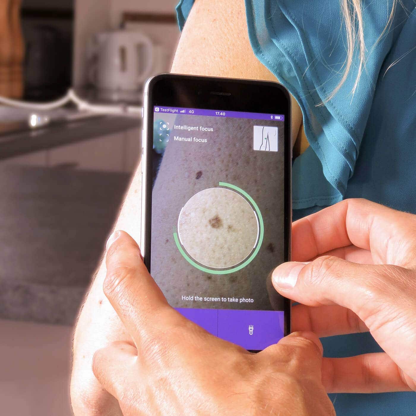 mole map app the miiskin app helps you map your moles