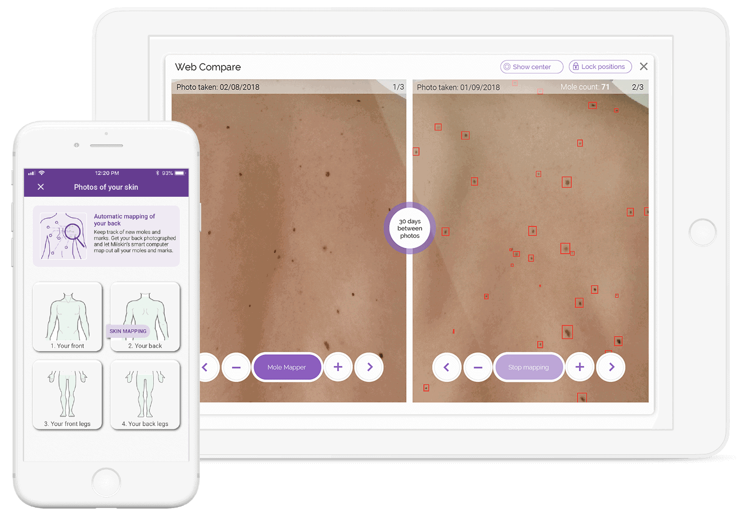 skin mapping solution skin mapping with miiskin app