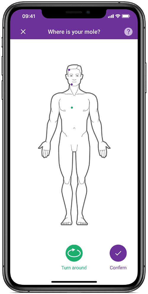 check your moles with app