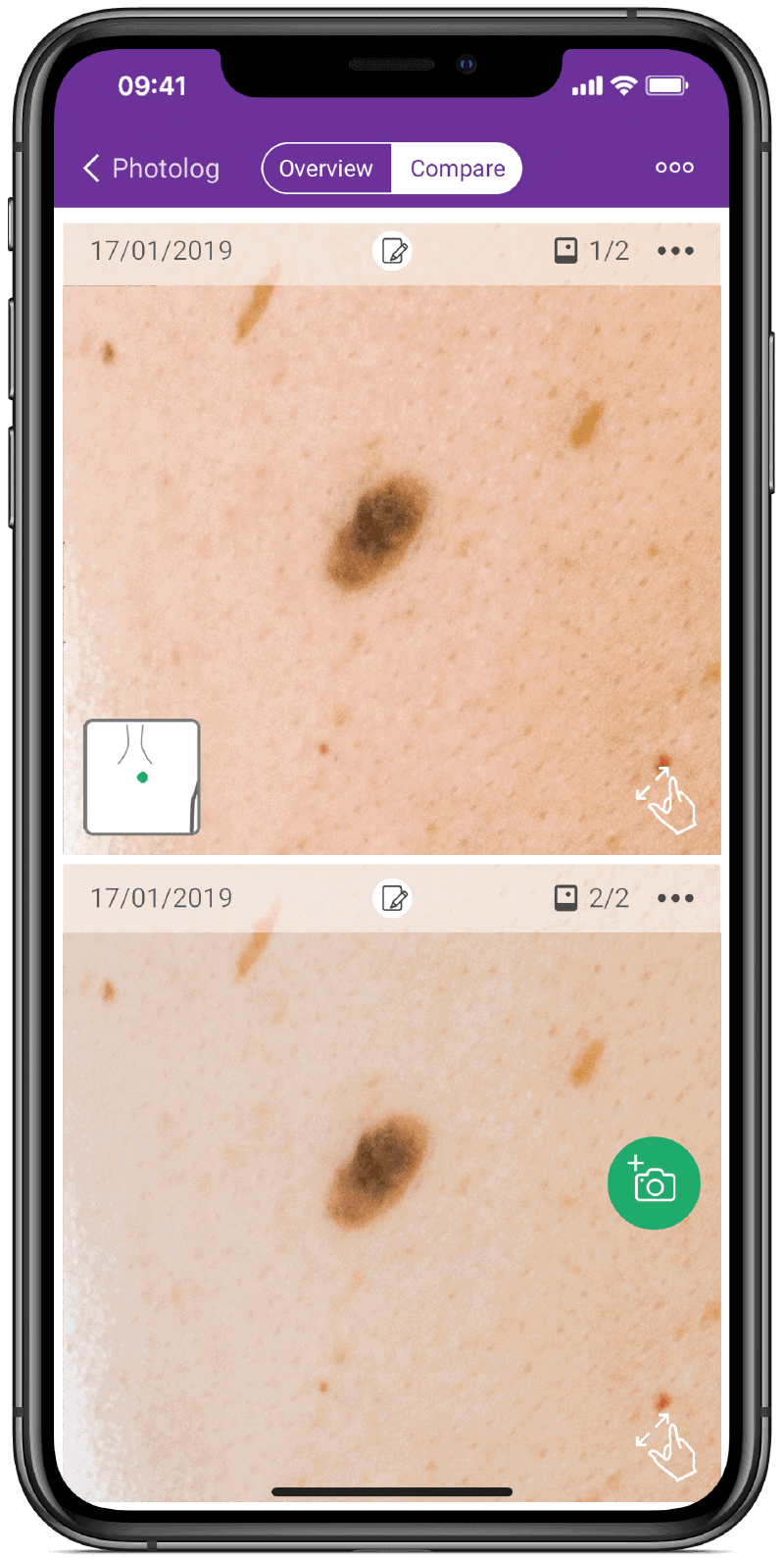 keep an eye on your skin with this app the miiskin app
