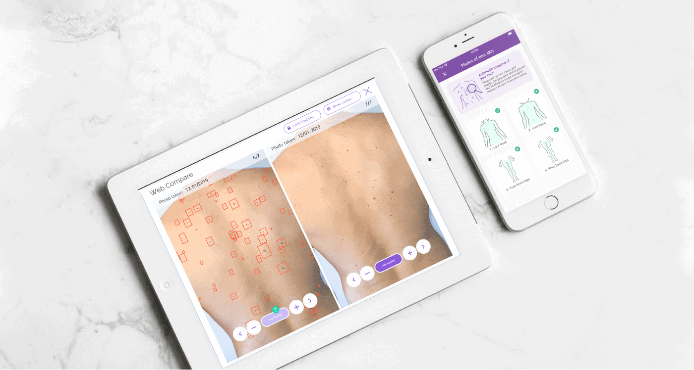 skin and mole checker app monitor your moles with miiskin app
