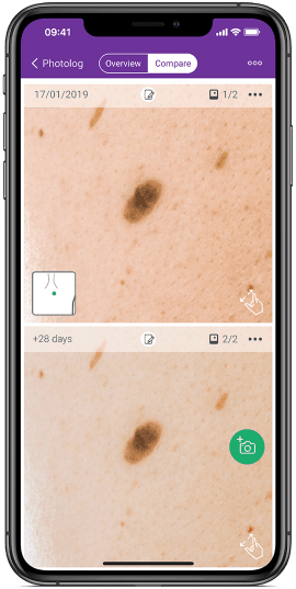 keep an eye on your skin with this app the miiskin app