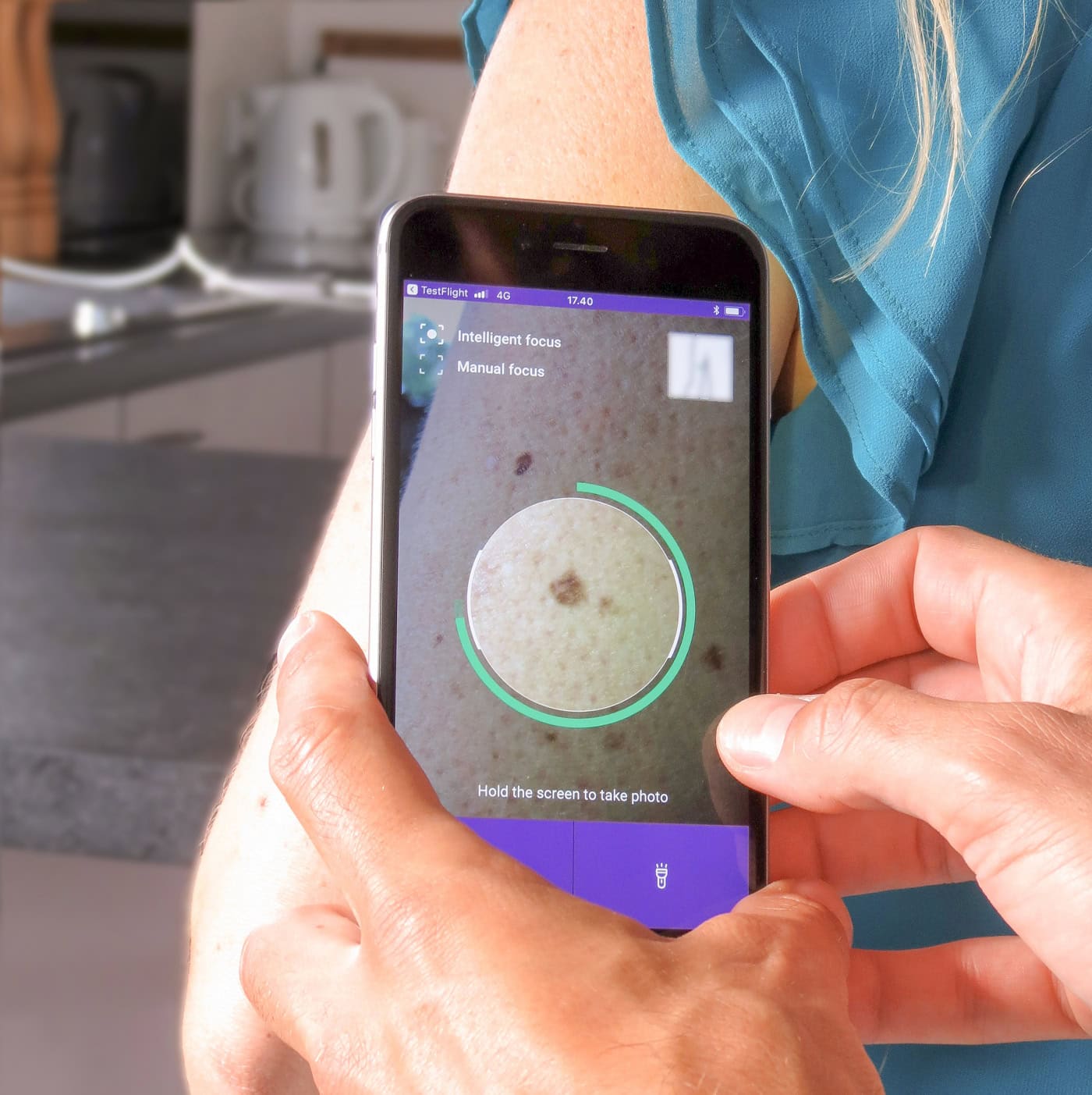 Mole Mapping Guide Getting a Mole Map & What You Should Know