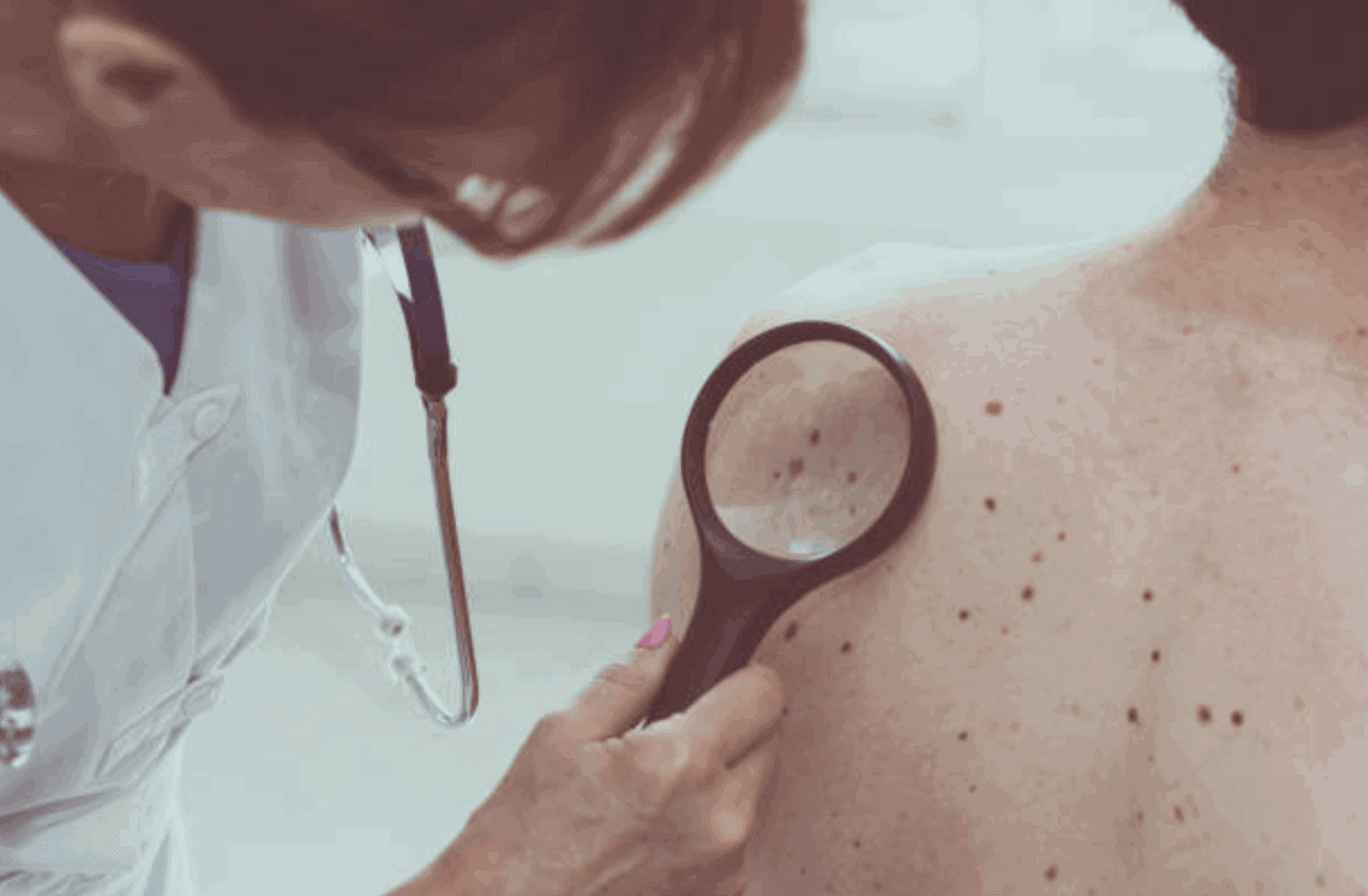 monitor your moles track moles with app