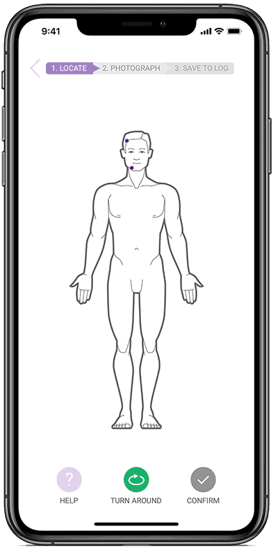 Pinpoint the moles you want to track Check your moles with app