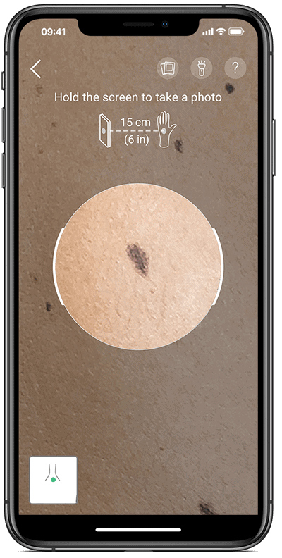 Skin self-exam App