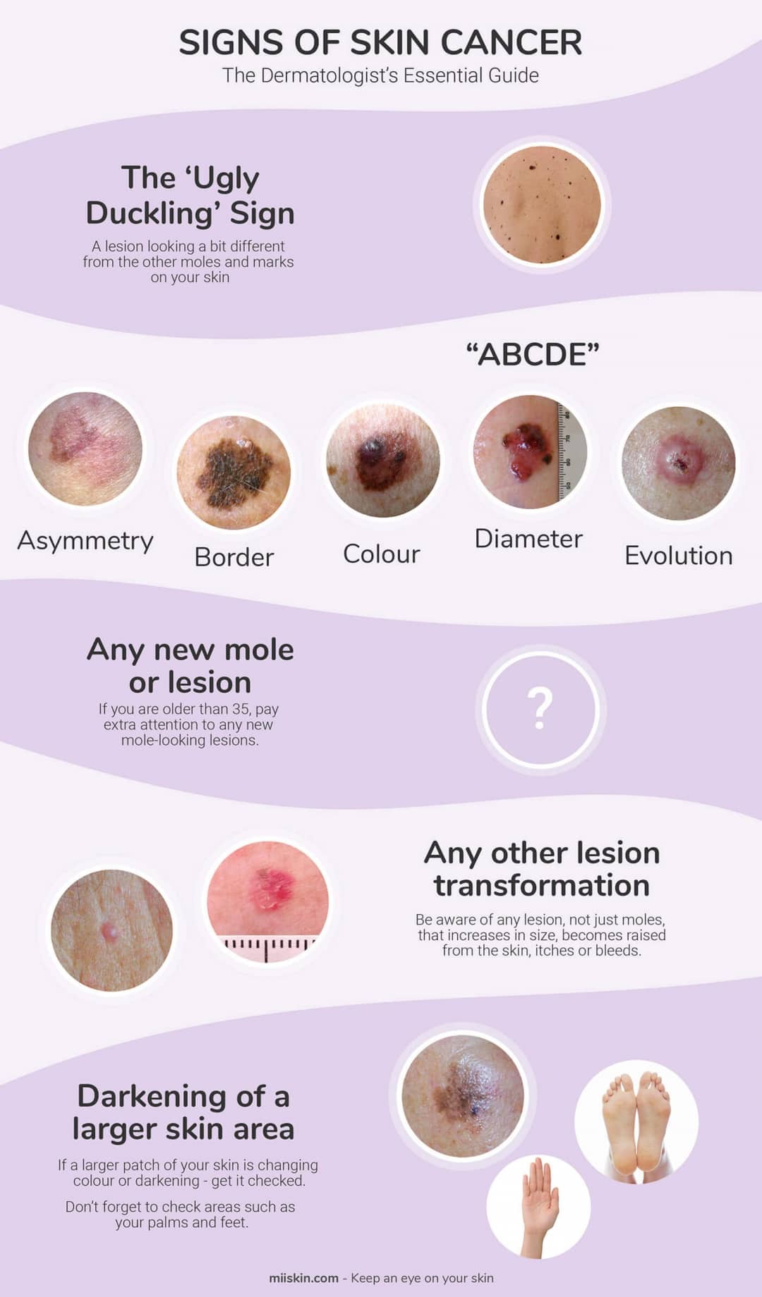 Skin Cancer Signs Symptoms The Dermatologist S Essential Guide The   Signs Of Skin Cancer Infographic 1080x1839 