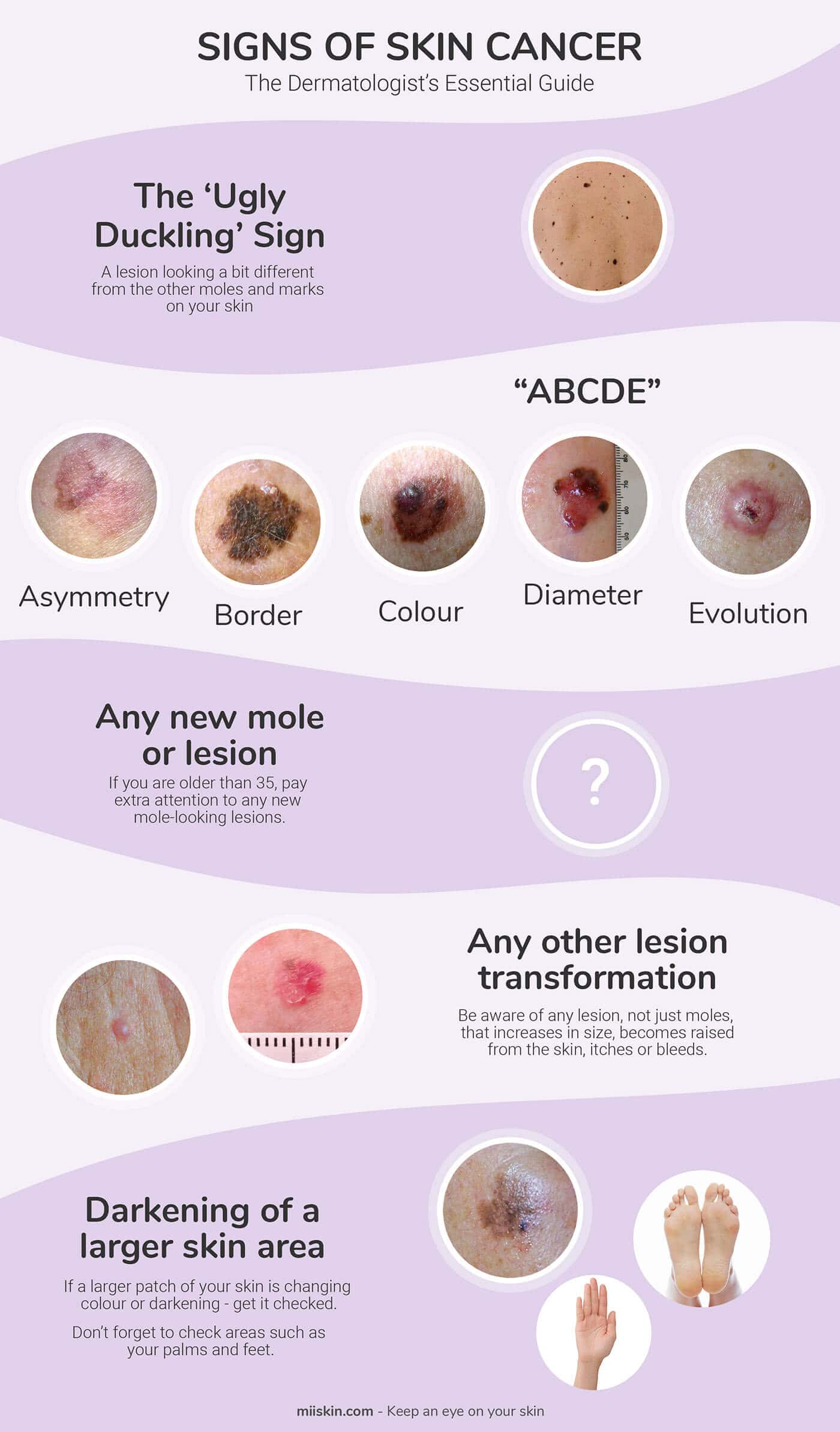 most common signs of skin cancer