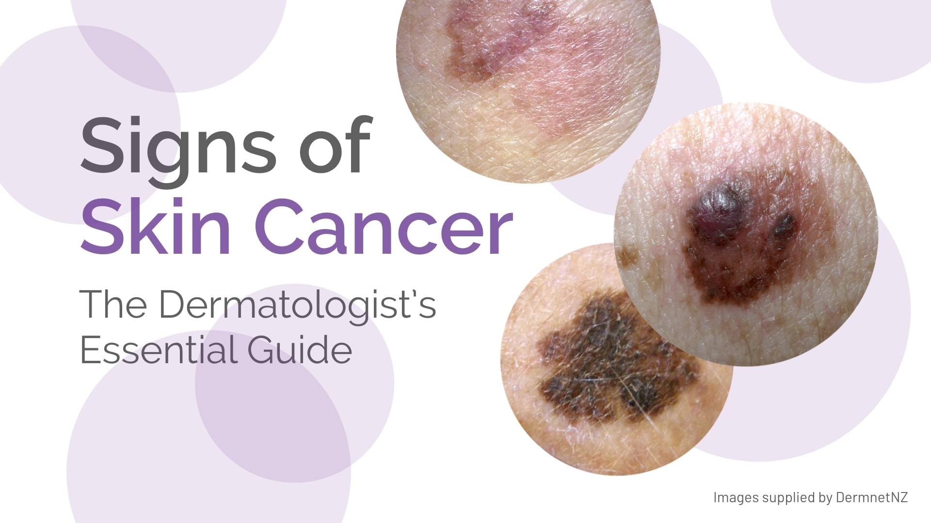 skin cancer symptoms pictures and signs