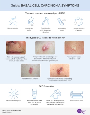 Basal Cell Carcinoma - Symptoms, Types and Pictures