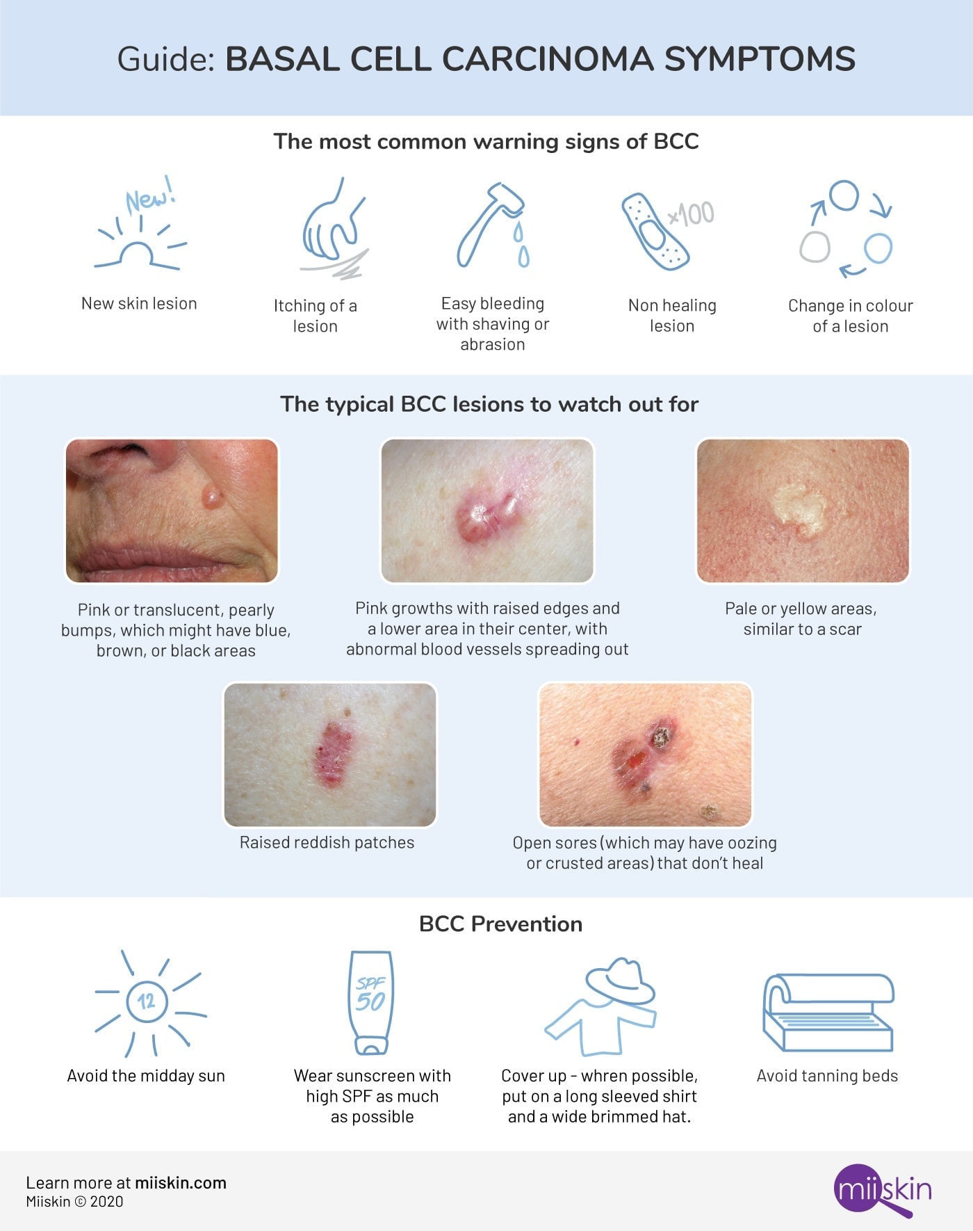 Basal Cell Carcinoma Symptoms Types And Pictures