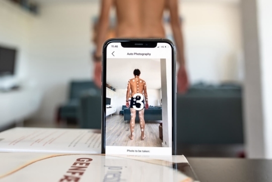 miiskin app audio instructions will guide you through skin imaging