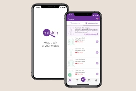 keep track of your moles with miiskin skin imaging