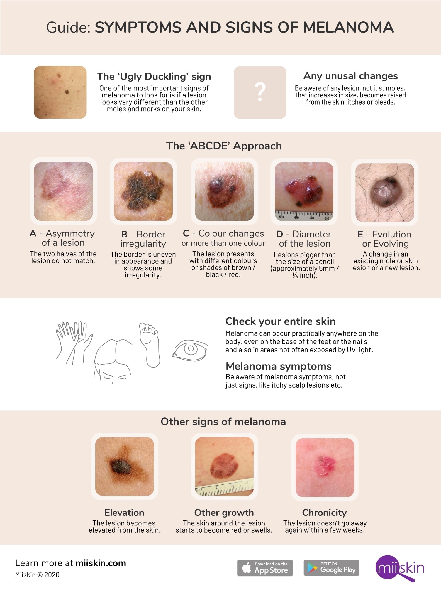 early melanoma symptoms and signs