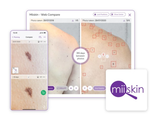 Miiskin Press Kit