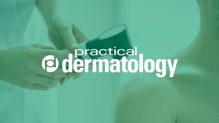 Practical Dermatology article