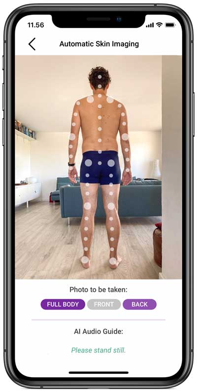Take full-body skin photos on your own Automatic Skin Imaging