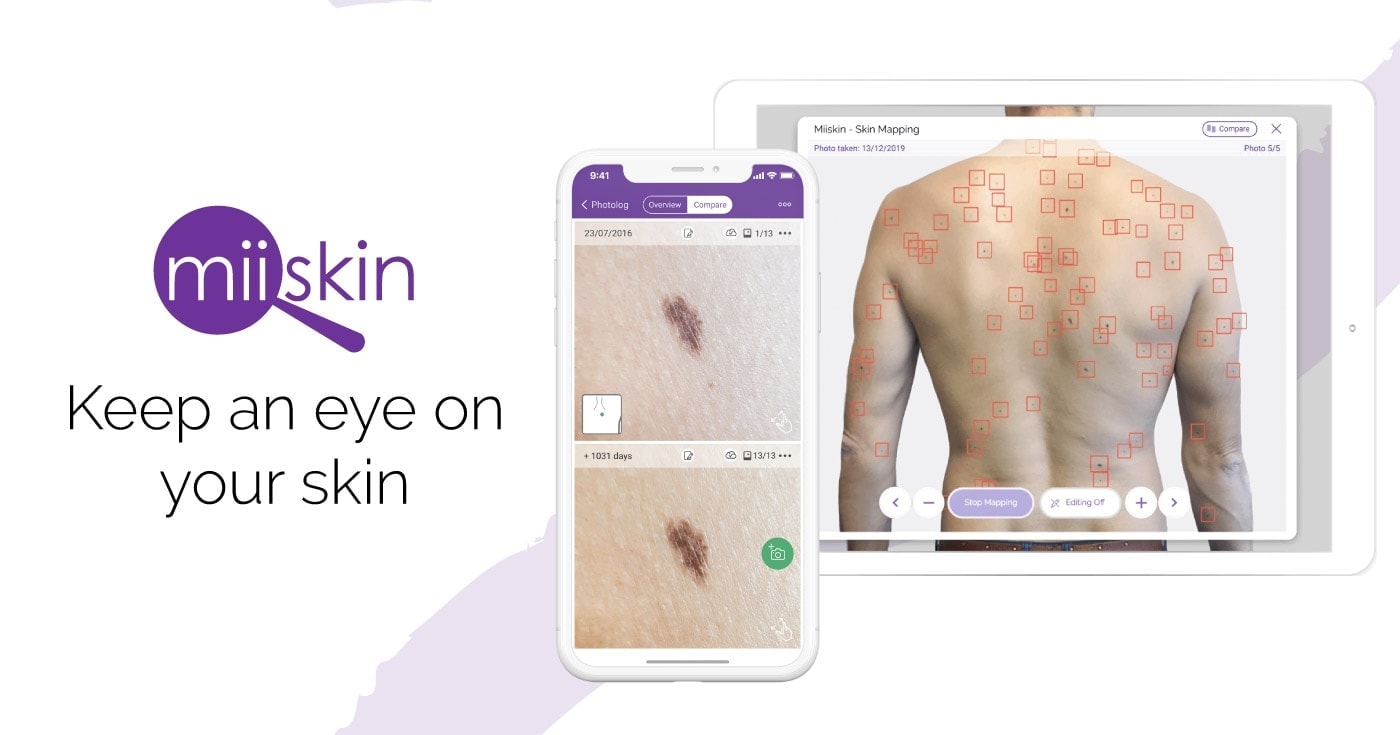 miiskin ai-powered app for skin tracking