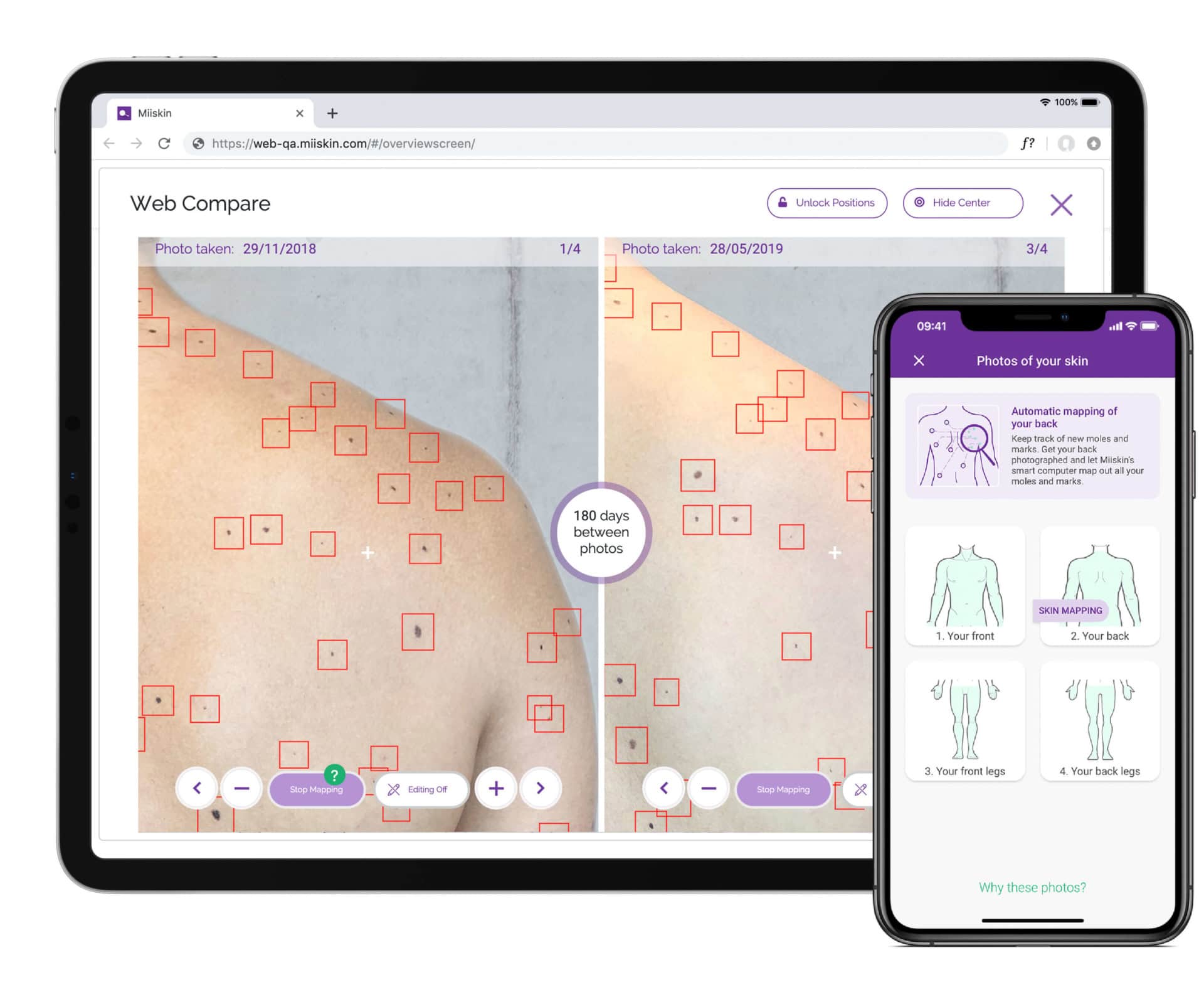 Miiskin's advanced features the future of skin monitoring
