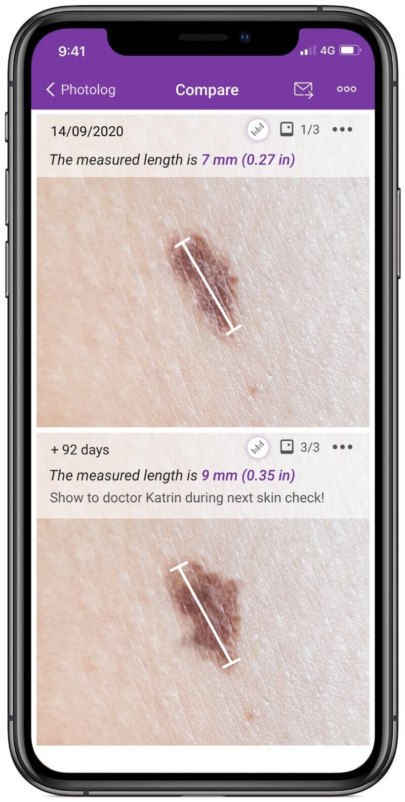 Compare photos of the moles over time Compare mole images over time