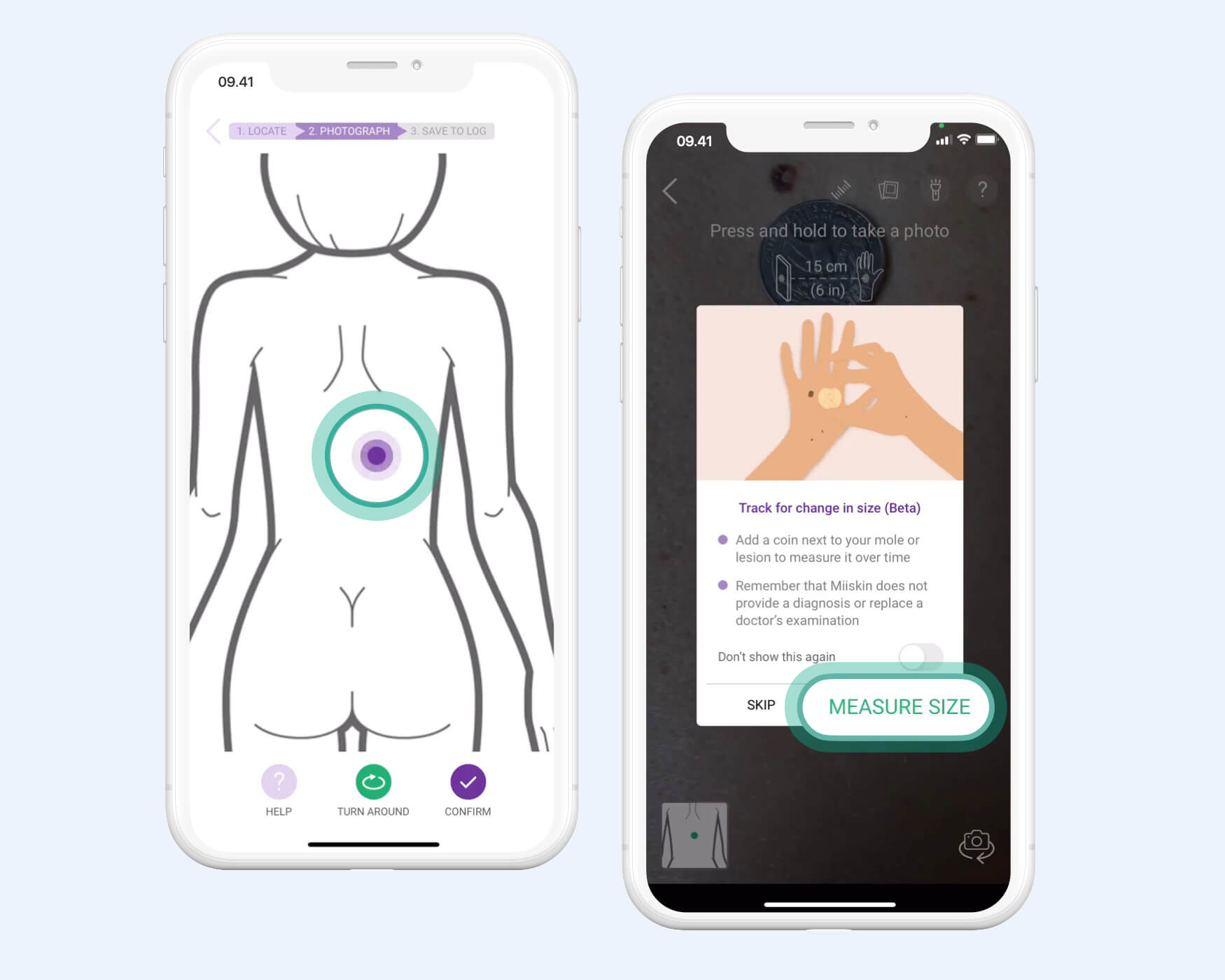 Mole Sizing Measure Your Moles With Miiskin