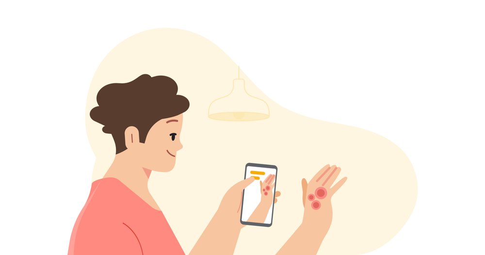 google derm assist app