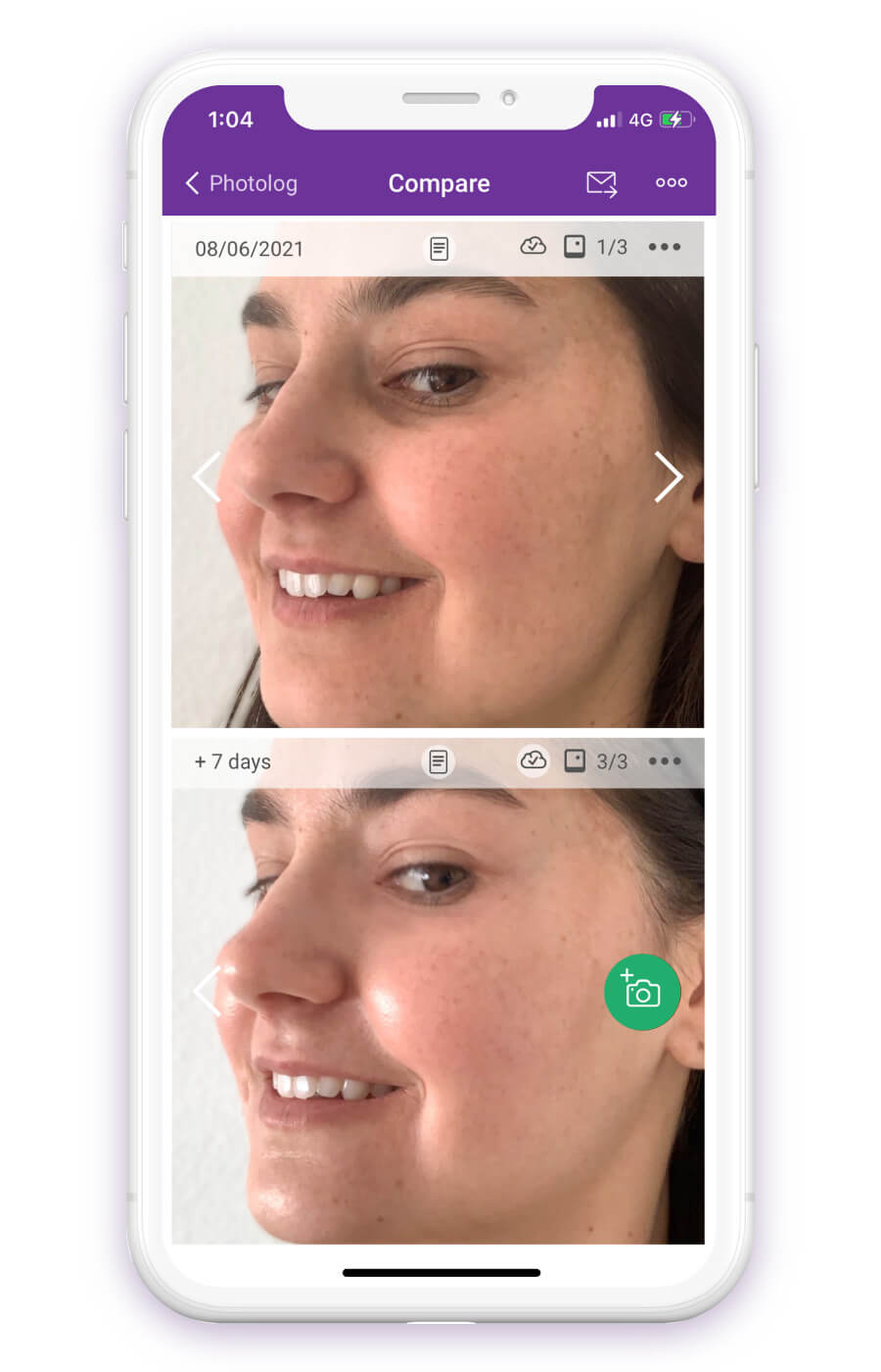 compare your skin progress over time