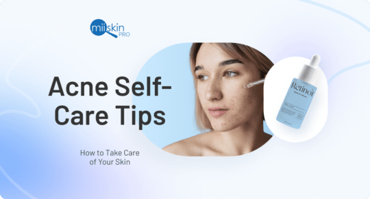 self-care tips for acne