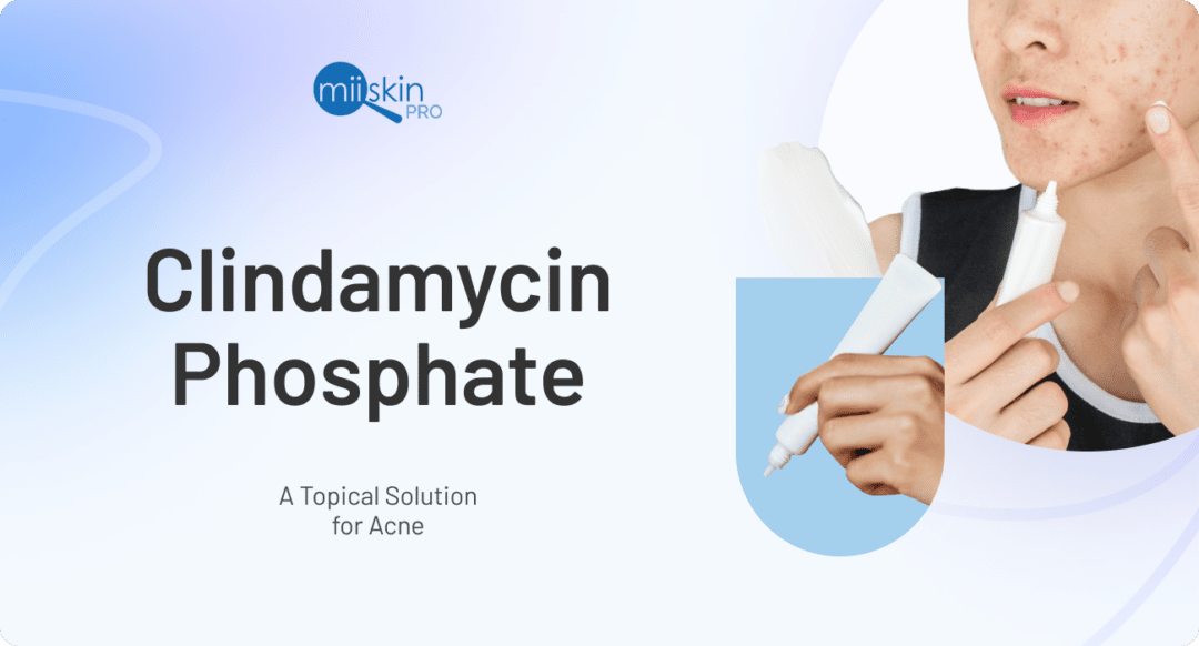 Doxycycline Hyclate vs Monohydrate for Treating Acne