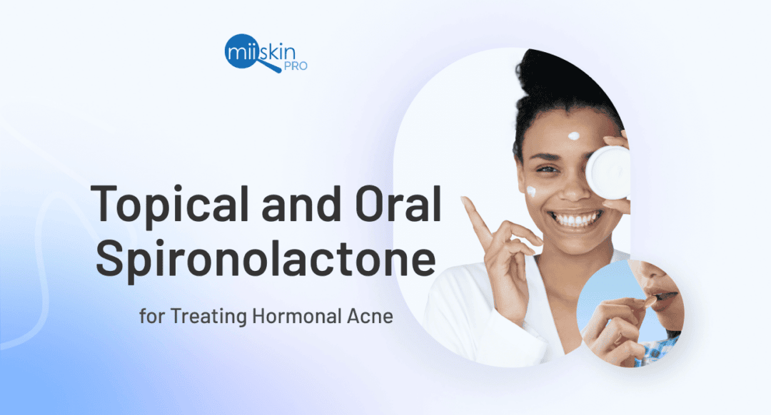 Clindamycin Gel for Acne Patient Guide