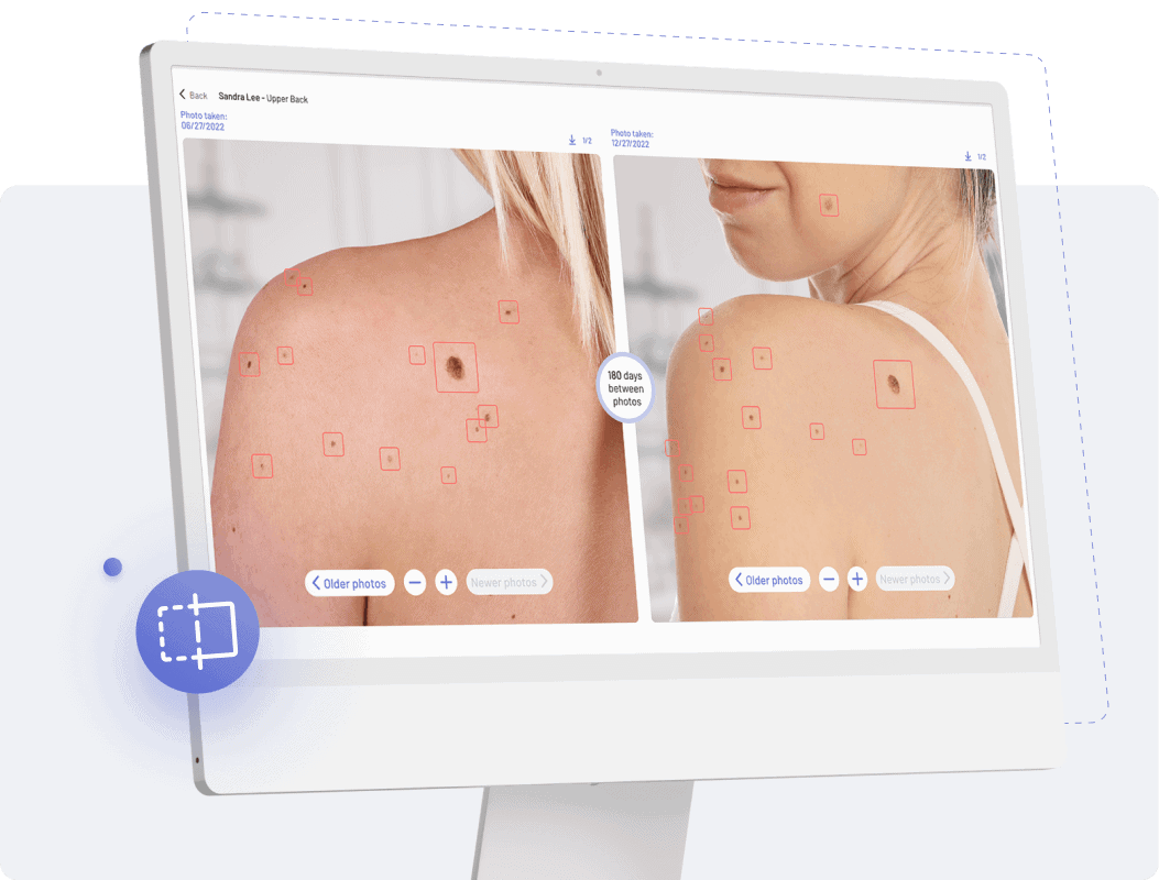 compare photos of your skin over time