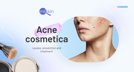 acne from makeup