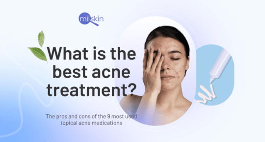 best treatment for acne