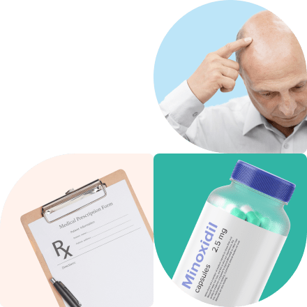 medications for hair loss