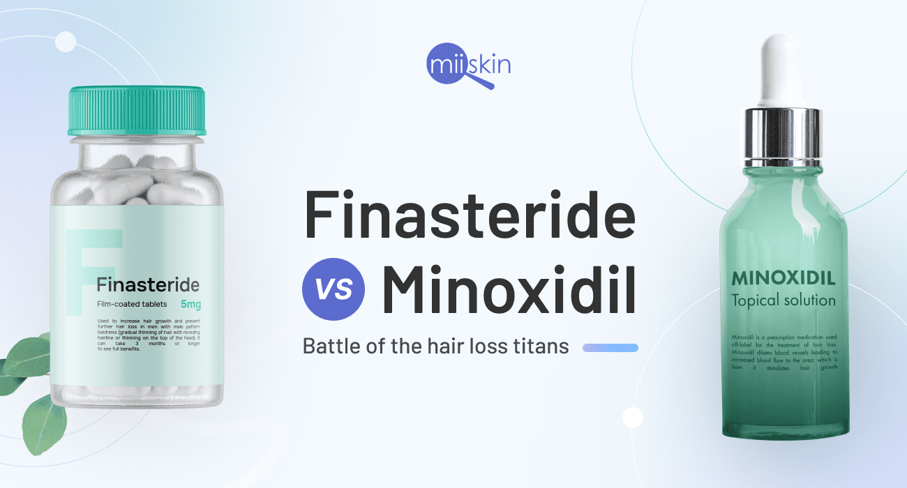 minoxidil vs finasteride for hair loss