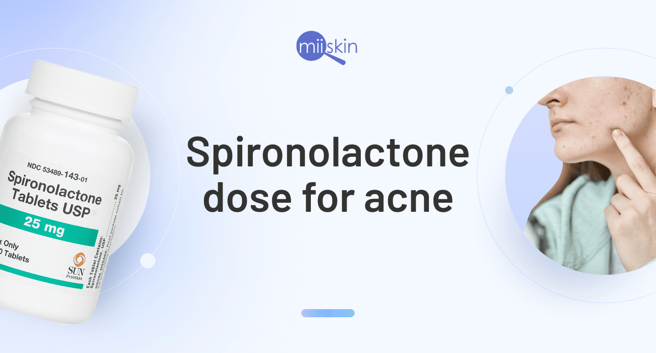 What is the right spironolactone dose for acne?