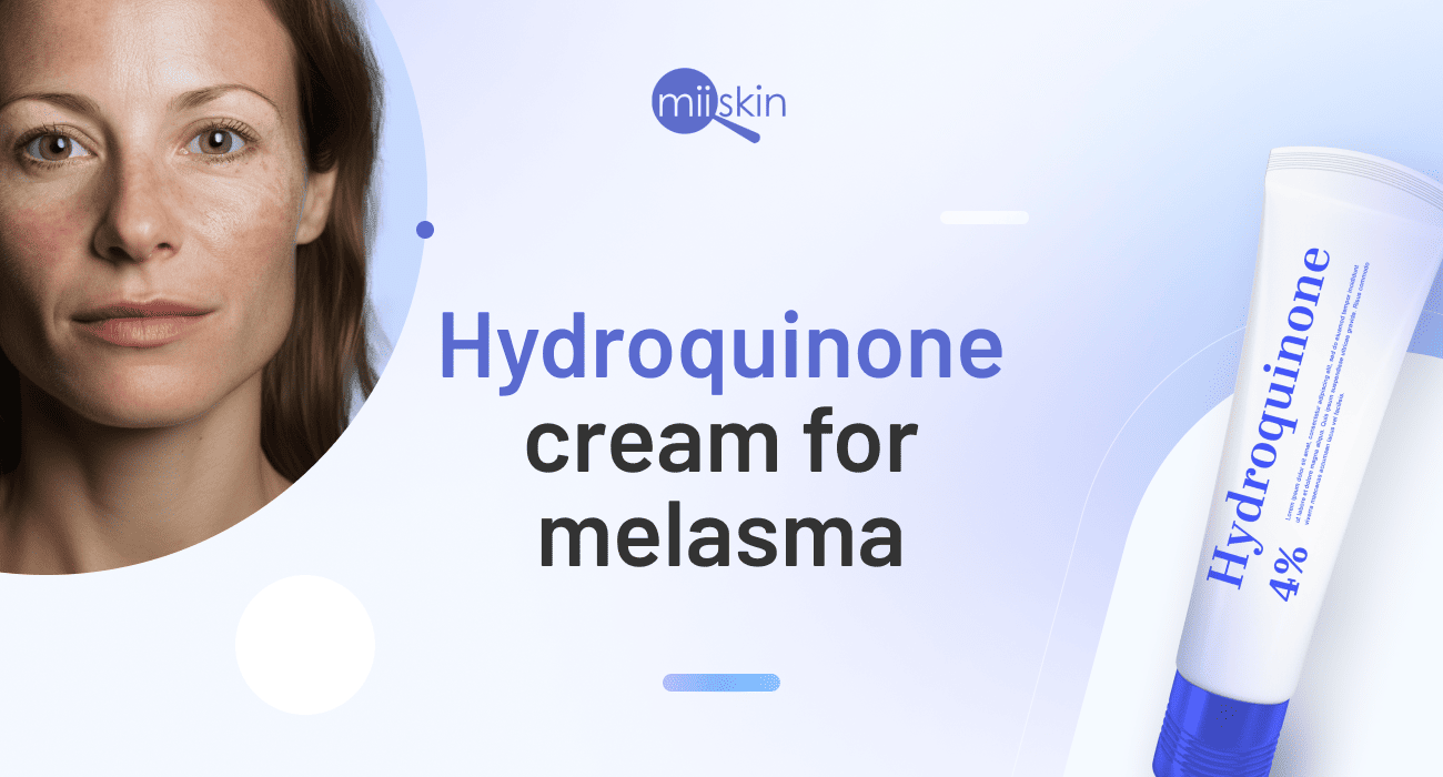 hydroquinone for hyperpigmentation