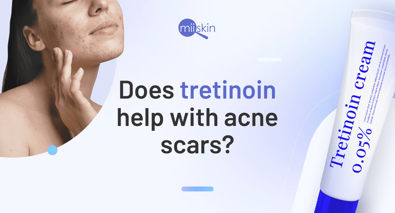 Does Tretinoin Reduce The Appearance Of Scars And Dark Spots 