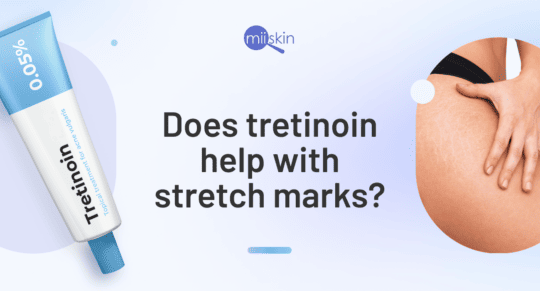 tretinoin-for-stretch-marks
