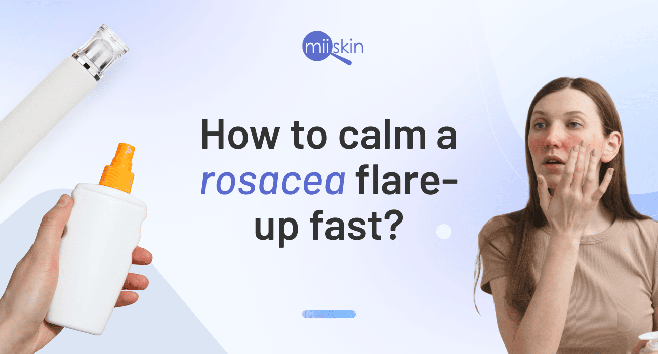 how to deal with a rosacea flare-up