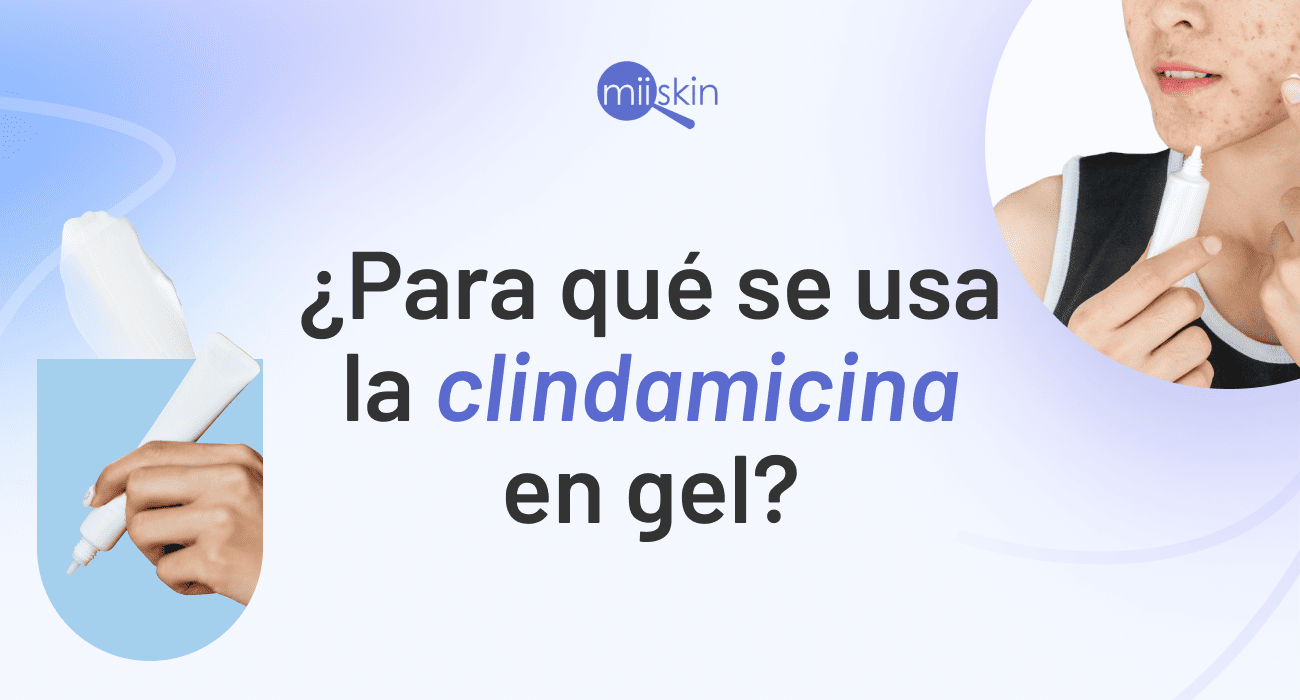 clindamicina gel