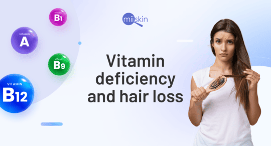 vitamin deficiency causing hair loss