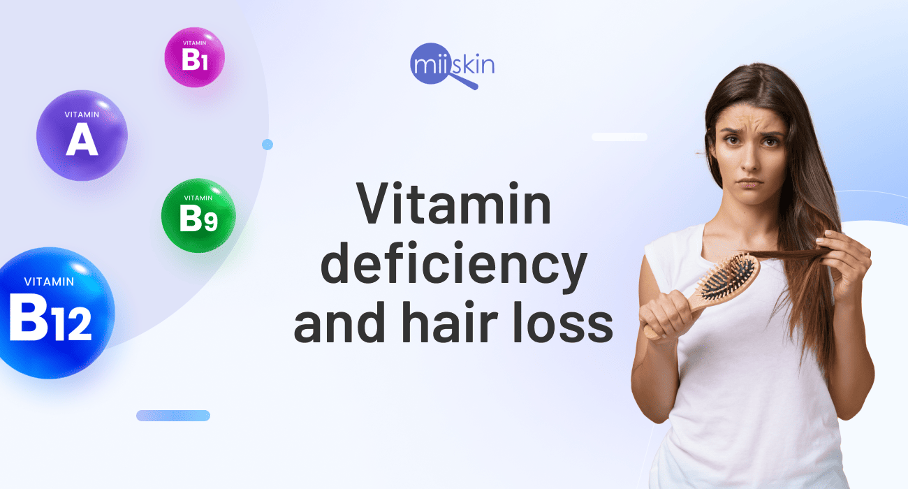 Most Common Vitamin Deficiency For Hair Loss Infoupdate