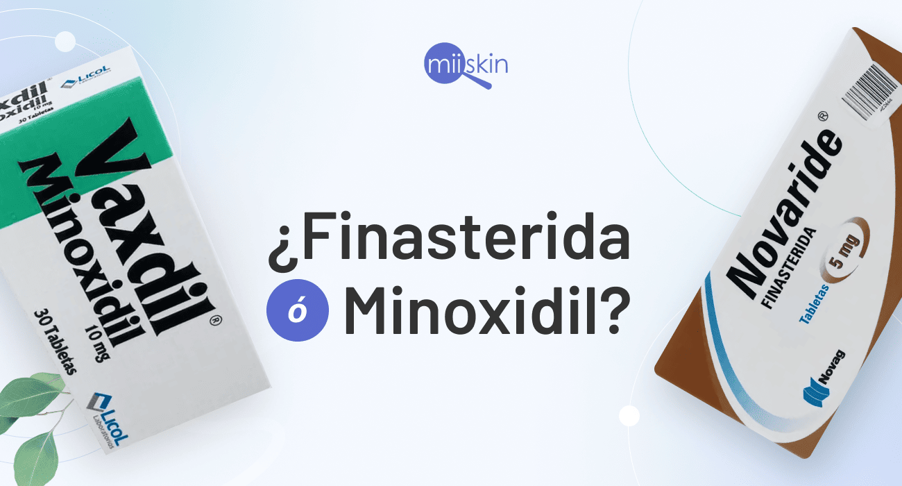 minoxidil o finasteride