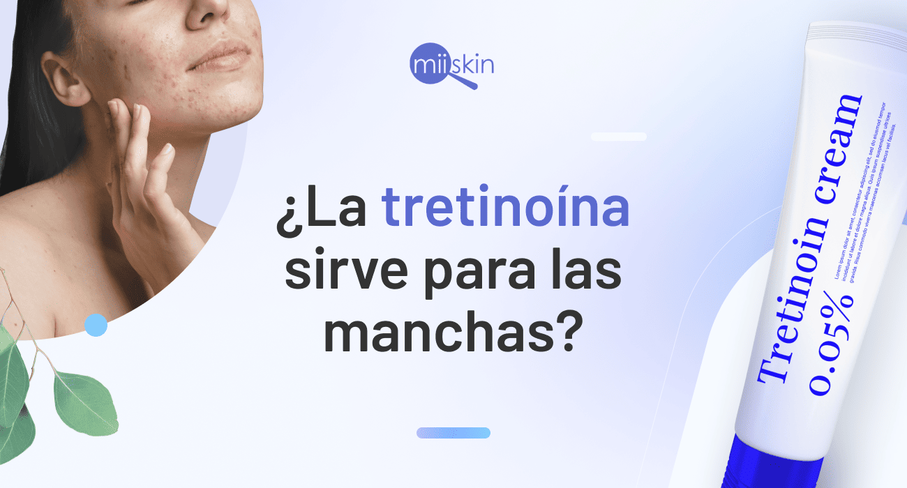 sirve la tretinoina para las manchas