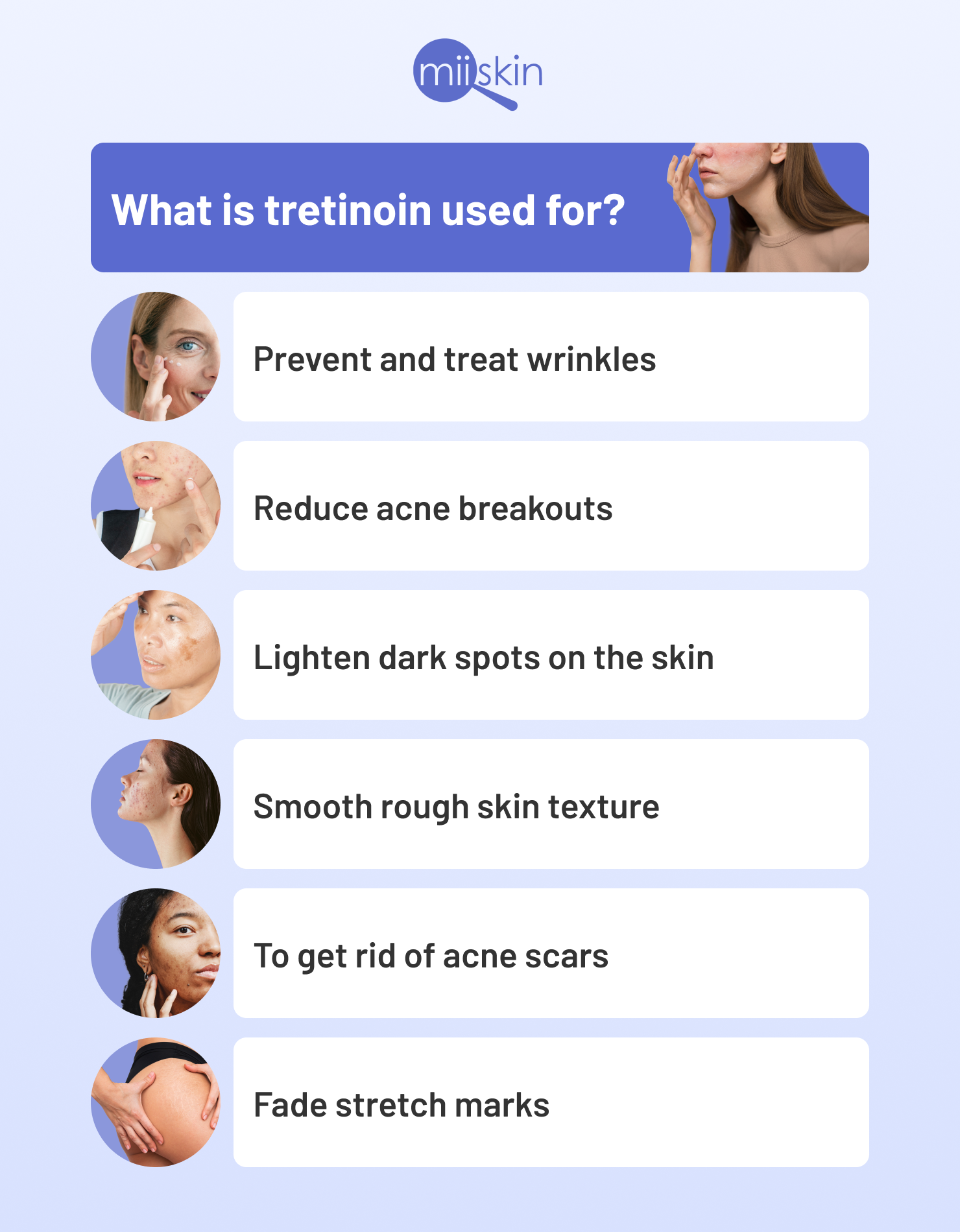 what-is-tretinoin-used-for