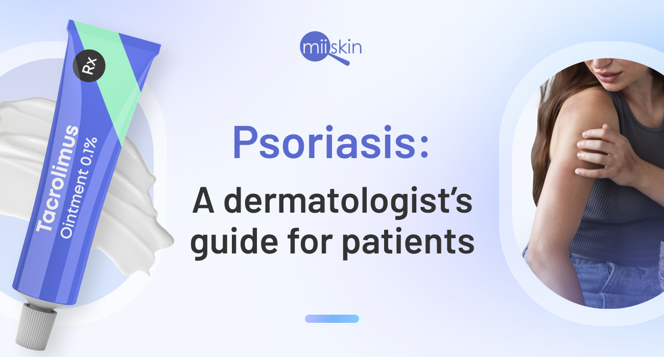 psoriasis guide for patients