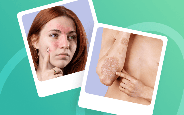 skin problems and diseases